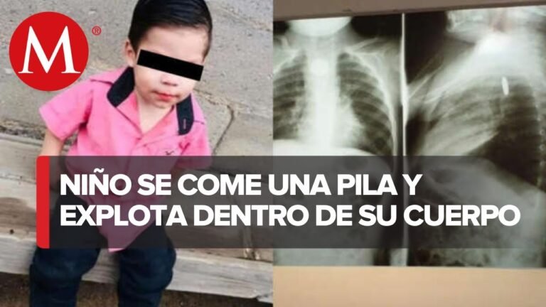 un nino se traga una pila